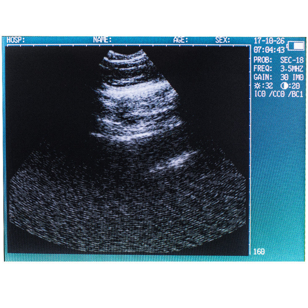 http://www.veterinaryultrasounds.com/cdn/shop/products/s-l1600_e4ed4cf9-f835-4da5-832c-c262bdf0a107.jpg?v=1571439542