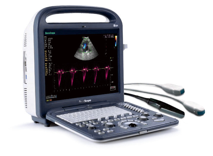 SonoScape S2V Ultrasound-Portable Color Doppler, Practical, Affordable ...