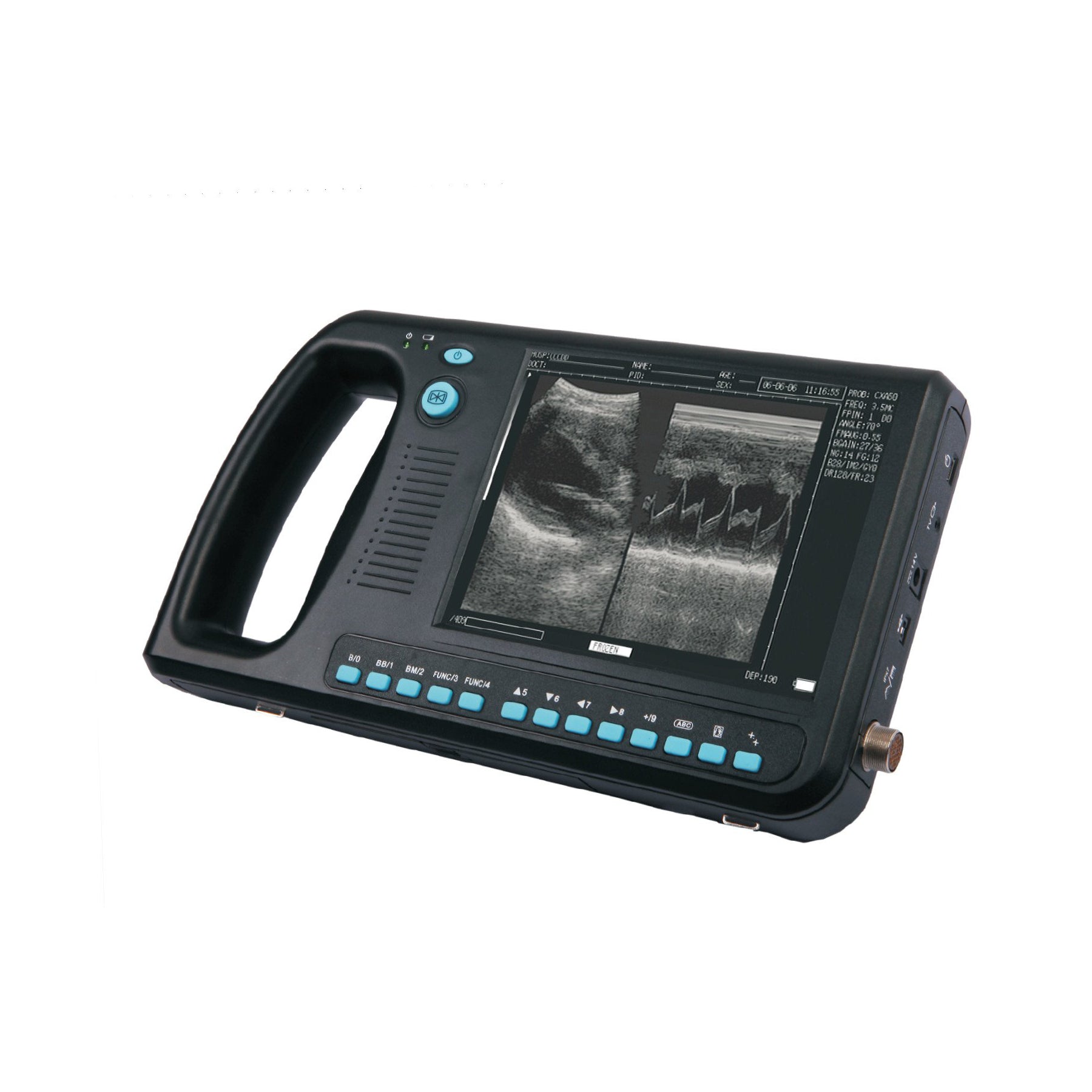 https://www.veterinaryultrasounds.com/cdn/shop/products/wed-30001800px_1800x.jpg?v=1604682853